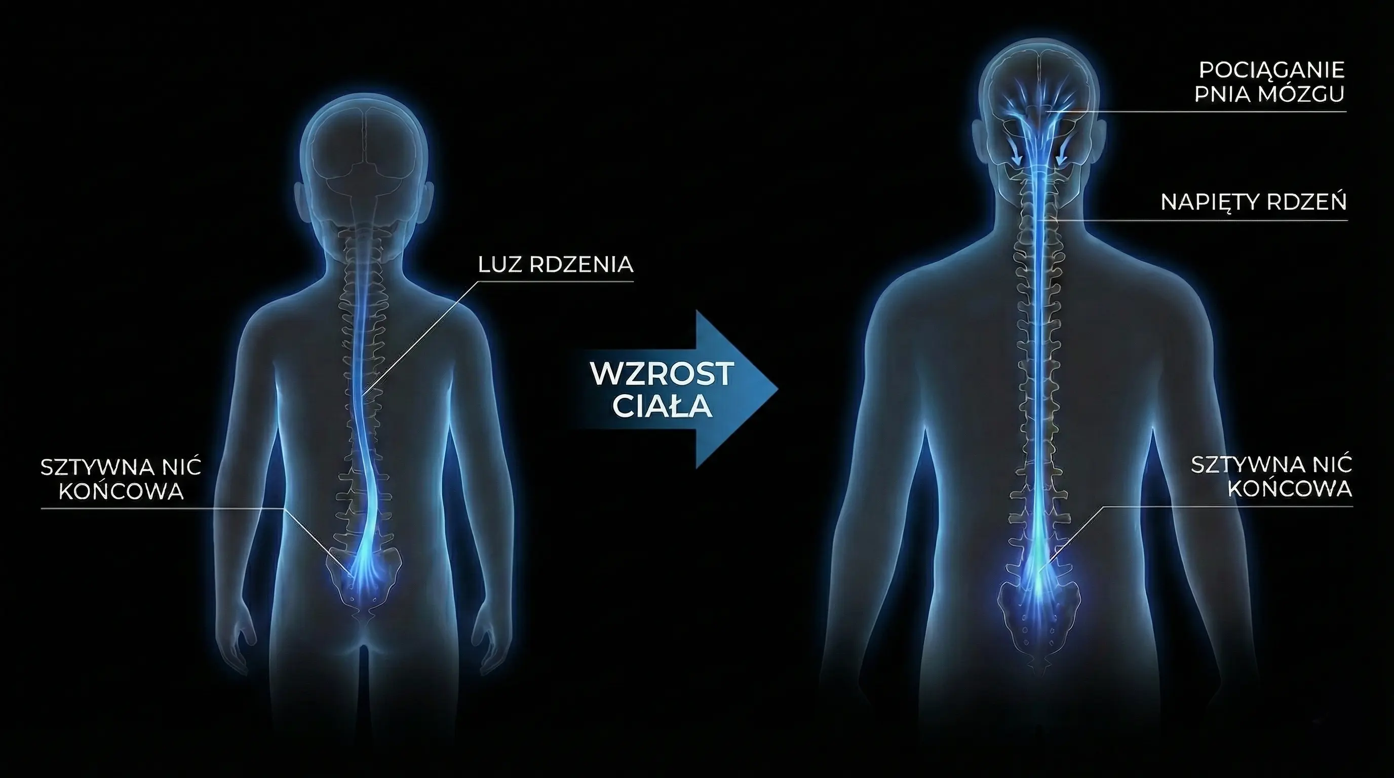 Schemat wstępowania rdzenia kręgowego (Ascensus Medullae) - tryb ciemny