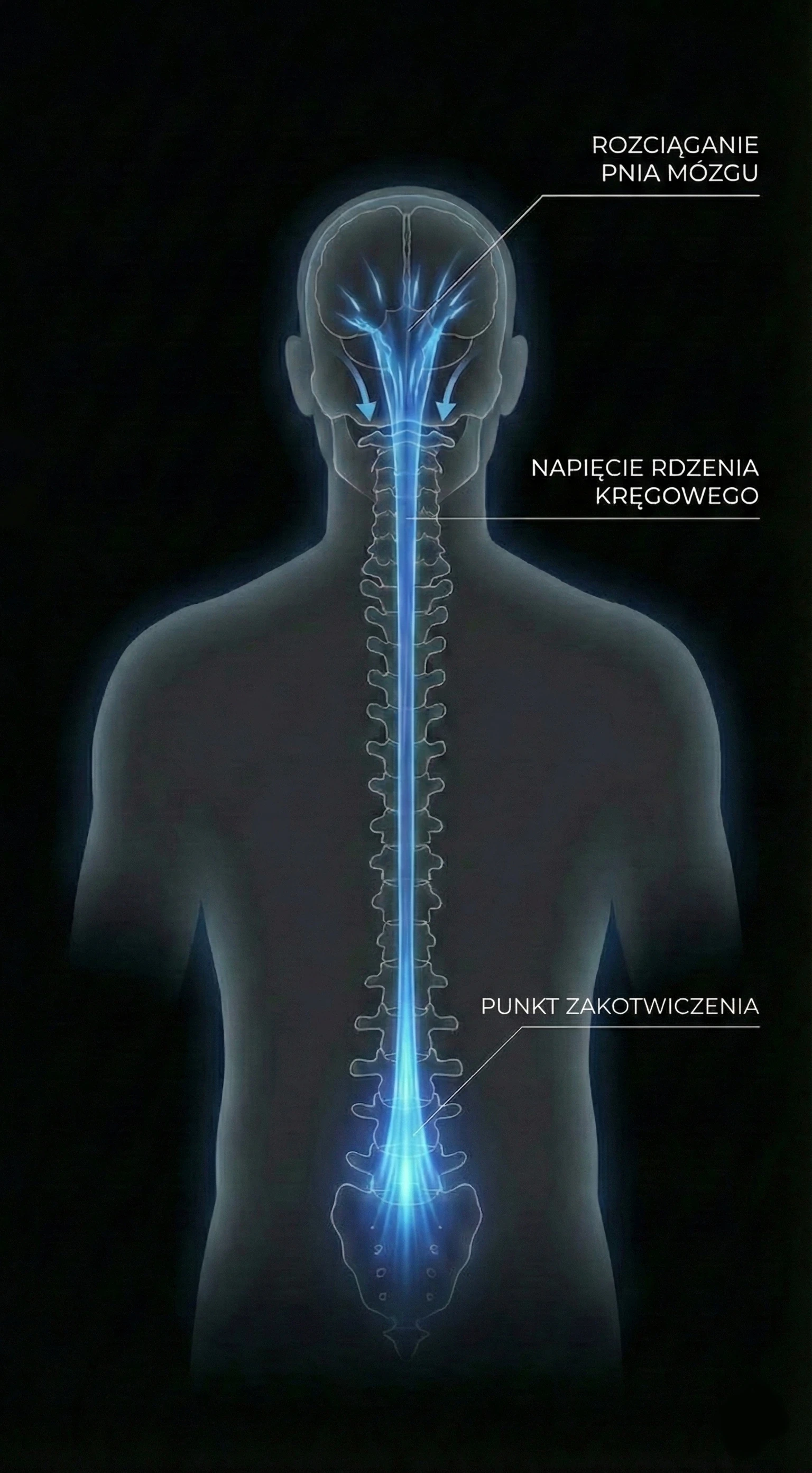 Schemat patomechanizmu Zakotwiczenia Rdzenia (TCS) - tryb ciemny